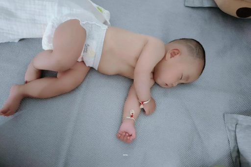 临朐宝宝脸上有白色斑块